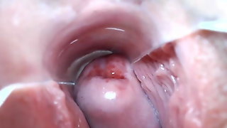 Cervix show 7