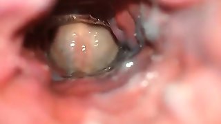 View that is inner